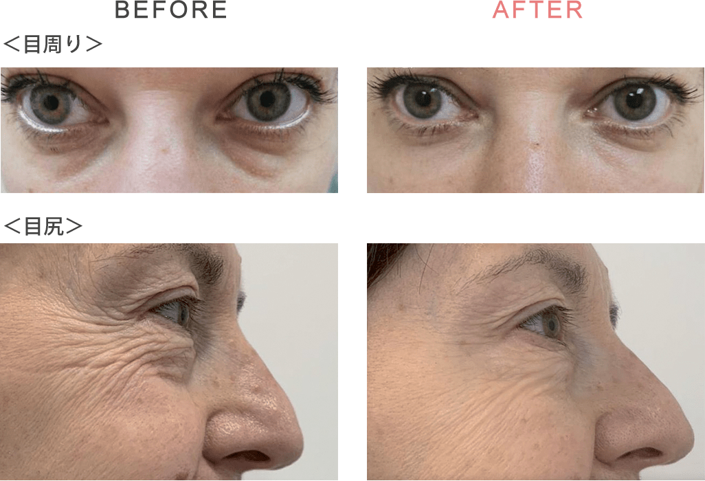 ジャルプロ　施術例