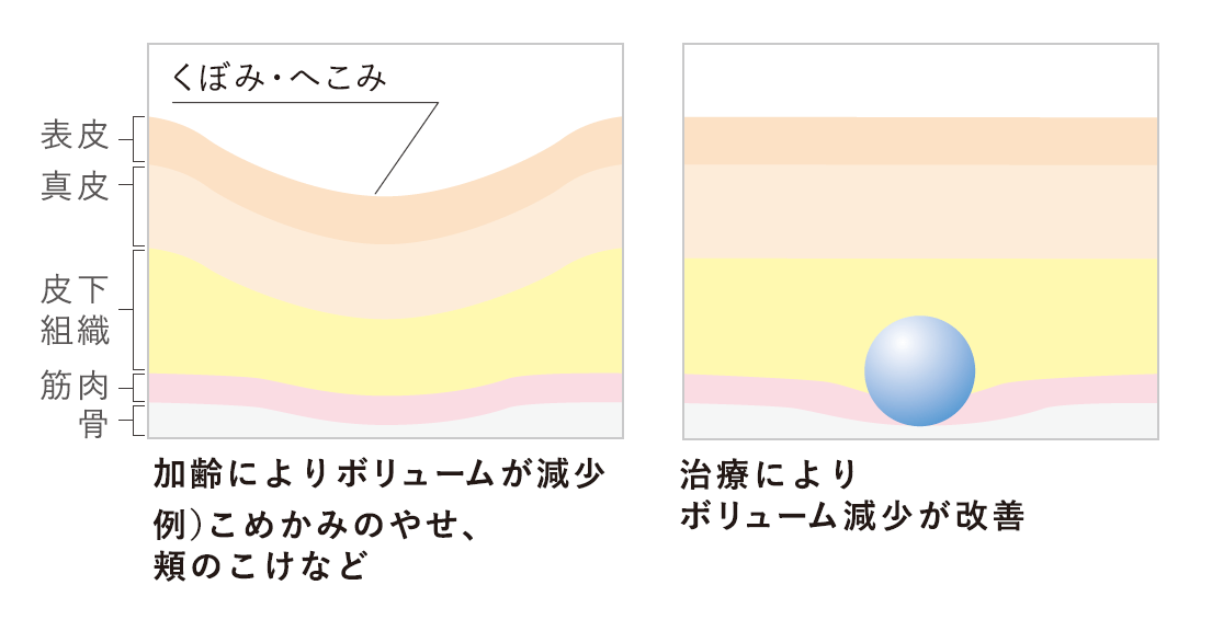 年齢とともに変化する骨格・脂肪・皮膚のバランスを立体的に整え、自然な若返りを実現します。